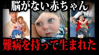 生まれながらに難病…とんでもない姿で生まれた子供たち５選【ゆっくり解説】