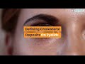 cholesterol deposits on eyelids treatment by xanthel ® easy cholesterol deposit removal