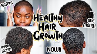 PCOS & ALOPECIA SUFFERERS🤩 THIS Is How I DOUBLED My Hair Growth Using 2 METHODS!! | Laurasia Andrea