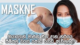 ✔මේ දවස් වල නිතරම මාස්ක් දාන නිසා ඔයාටත් මේ ගැටලු තියෙනවද  MASKNE treatment in sinhala | oshi vlogs