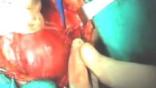 Live surgery clinic operation