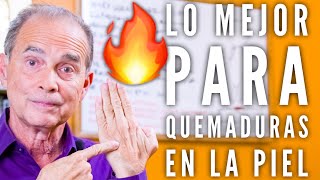 Episodio #1998 Lo Mejor Para Quemaduras En La Piel