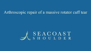 Arthroscopic repair of a massive rotator cuff tear