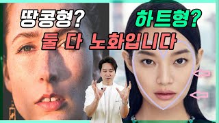 어떤 얼굴형이든 다 쳐집니다!(땅콩형 VS 하트형)/ 청담동 금손 김원장 #땅콩형얼굴#노화예방