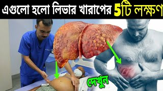 লিভার খারাপ হওয়ার আগে যে যে লক্ষণ দেখা দেয় | Early Sign Of Liver Damage