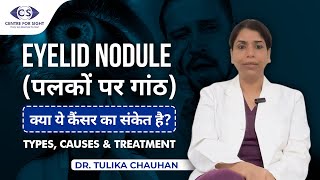 The ABSOLUTE BEST Way To Treat Eyelid Nodules With Dr Tulika Chauhan