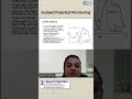 Evoked Potential Monitoring by Dr. Gayatri Sarikar | Conceptual Anesthesia