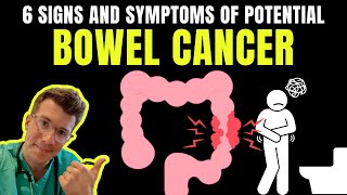 6 SIGNS AND SYMPTOMS OF BOWEL CANCER