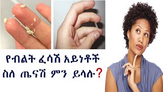 የማህፀን ፈሳሽ ስለ ጤናችን ምን ይነግረናል??? types of vaginal discharge and their meaning related to health