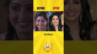 Bollywood | Before & After #shorts #beforeafter #bollywood