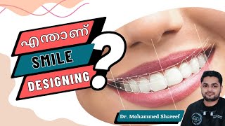 എന്താണ് Smile Designing| Smile Correction Treatment