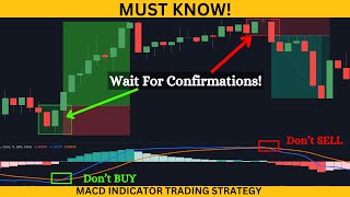 ⚫️Ultimate Macd Indicator Trading Course