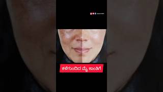 ಕಳೆಗುಂದಿದ ಮುಖಕ್ಕೆ ಬೆಸ್ಟ್ ಸೊಲ್ಯೂಷನ್ಸ್/ How to remove dull skin naturally.