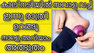 ഉറങ്ങും മുന്‍പ് കാലിനടിയില്‍ സവാള വെച്ചാല്‍ | Onion Health Benefit| Health Tips Malayalam | Ayurveda