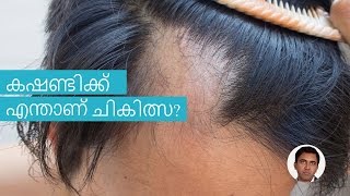 കഷണ്ടിക്ക് ചികിത്സയുണ്ട് (Cure to Baldness) | Malayalam