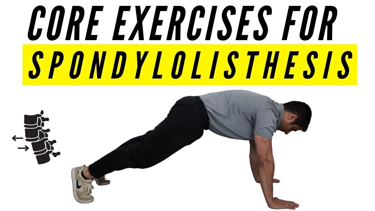 Core Exercises For Spondylolisthesis - YouTube