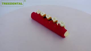 Periodontal Disease Model