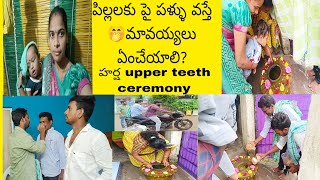 పిల్లలకు పై పళ్ళు ముందుగా వస్తే ఎం చేయాలి🤔 ||ఆశ్చయంగా ఉంది కదా 🤭