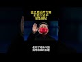 金正恩治疗方案，打脸习近平，被急删帖 shorts