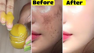 Apply this👆🏼Turmeric Gel for 7 Days and see what happens-No Spots and Dark Skin-Get Light Fair Skin