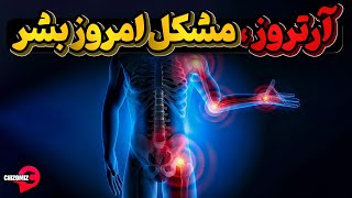 آرتروز، نقرس و رماتیسم مفصلی چگونه زندگی انسانها را تحت تاثیر قرار می دهد