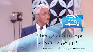 هل أنت غير راض عن شكلك؟.. ربما تكون مصاب باضطراب التشوه الجسمي