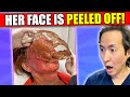 Plastic Surgeon Reacts to Face Peeling Off Videos! #phenol peel