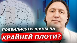 ТРЕЩИНЫ | Причины трещин на крайней плоти у мужчин. Они пройдут самостоятельно?