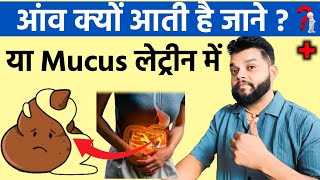 आँव या Mucus क्यों आती है लेटिन मे 🔥 Mucus In Stool In Hindi | Causes And Treatment