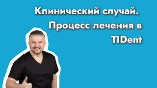 ЛЕЧЕНИЕ У ГНАТОЛОГА. Клинический случай