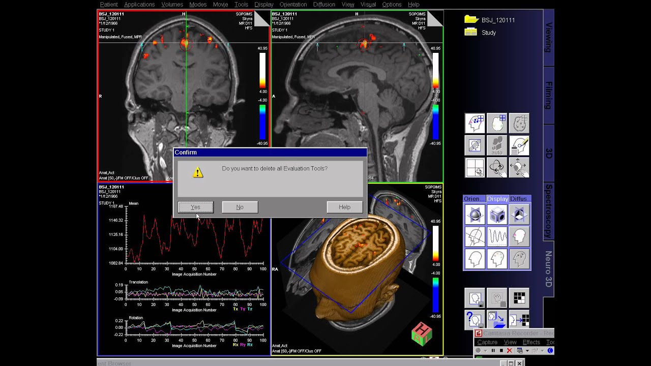 Fmri Analysis Youtube