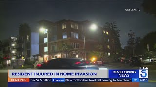 Larchmont resident assaulted during home invasion