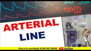 Arterial line | Transducer set-up | Arterial line-Zeroing | Square wave test | Nursing Alerts