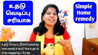 உதடு வெடிப்பு நீங்க/Cracked lips home remedy in tamil/ How to get rid of dry chapped lips / Dry lips