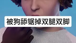 被狗舔了一下就要去锯掉双手和双脚？知识科普 人体 狗