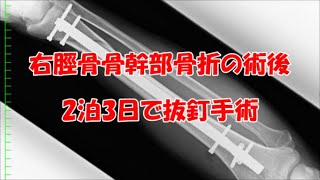 【CB1300SF事故】事故から1年、ボルトを抜きます