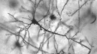 Neurobiological brain disorder | Wikipedia audio article