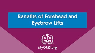 Benefits of Forehead and Eyebrow Lifts