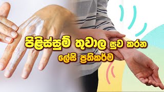 පිළිස්සුම් තුවාල සුව කරන ලේසි ප්‍රතිකර්ම #treatment #Easy #Burn #remedies s