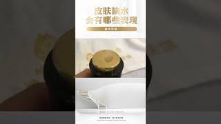 皮肤缺水会有哪些表现？皮肤百分之七十都是由水组成，所以日常护肤一定要补水锁水工作一起做，缺一不可 #皮肤问题#皮肤缺水#科技护肤