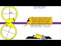 video 79. Manuver Semont dan Manuver Semont Plus