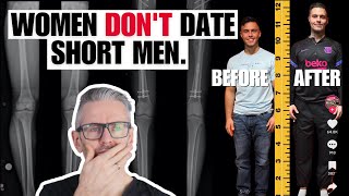 Shocking leg lengthening surgery! What's really driving men to undergo this extreme surgery?