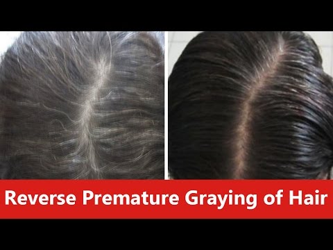 How to Reverse Premature Graying of Hair Naturally How to Reverse Premature Graying of Hair Naturally
