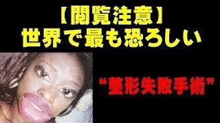 閲覧注意　世界で最も恐ろしい“整形失敗手術”はこれだ！！