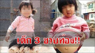 อยู่ๆลูกสาววัย 3 ขวบก็ท้องโต พาไปหาหมอ หมอบอก…. แม่ถึงกับต้องทำร้ายตัวเอง