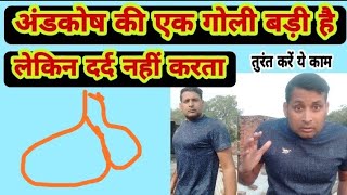 अंडकोष की एक गोली बड़ी है सूजन|लेकिन दर्द नहीं करता|Andakosh ki goli badi sujan|one scrotum large ?