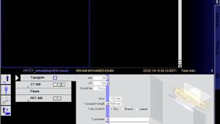 Pet CT examination (simens machine)