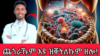 4 ጨጎራ ዘሕውዩ ኣገረምቲ ምግብታት