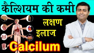 कॅल्शिअम की कमी लक्षण इलाज | calcium ki kami ke lakshan I calcium deficiency causes treatment