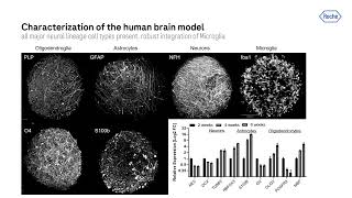 Chances \u0026 challenges for in vitro models to address CNS toxicities